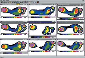 pressure-picture-of-non-neuropathic-foot