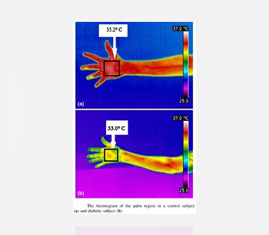 IR Thermal Imager