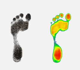 Plantar-Pressure-System-Podiascan