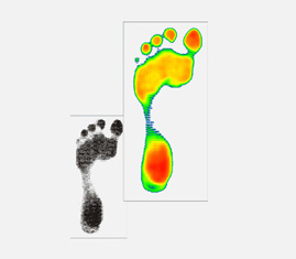 Plantar-Pressure-System-Podiascan